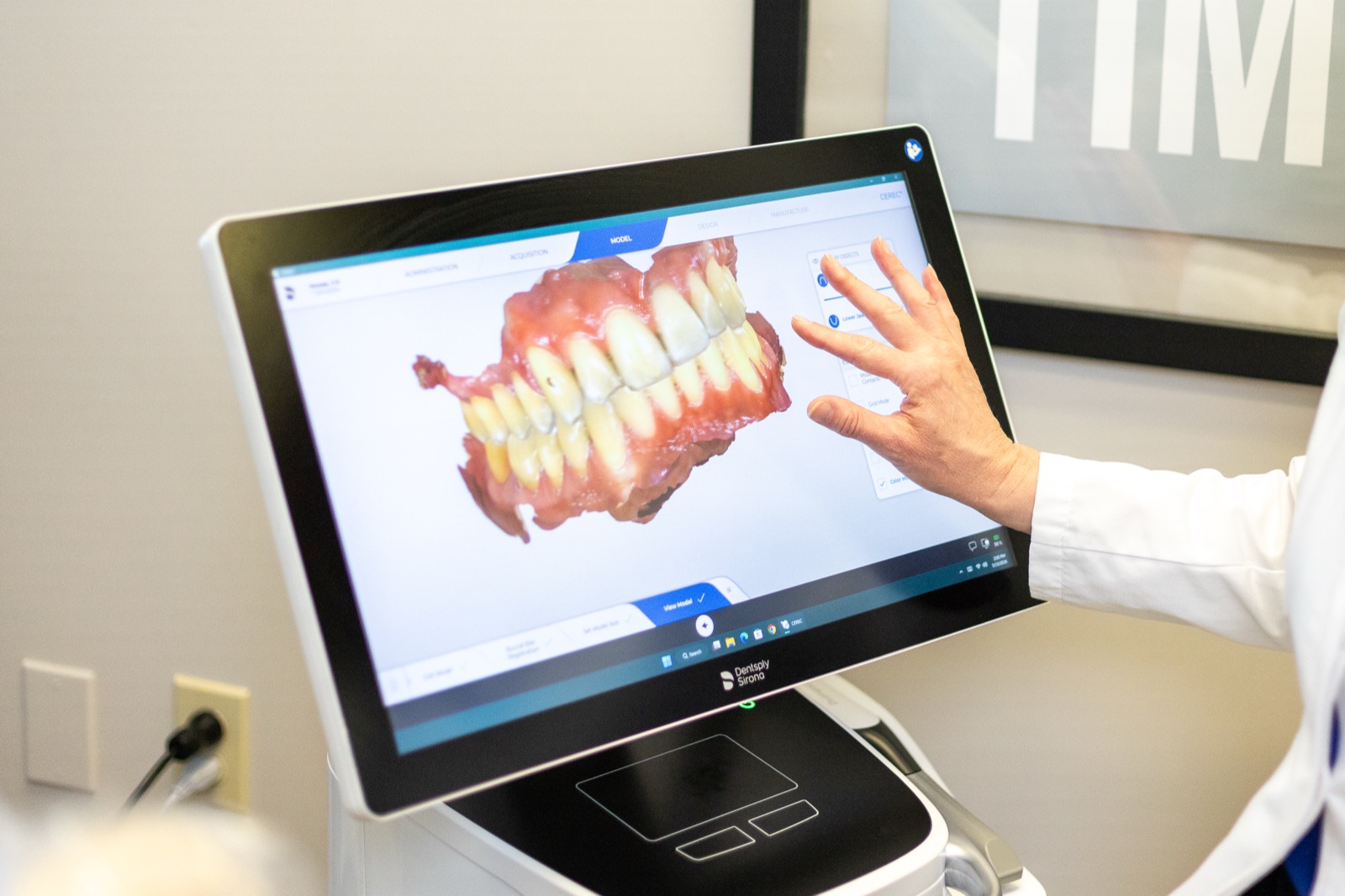 A 3D dental scan used to design a custom oral appliance