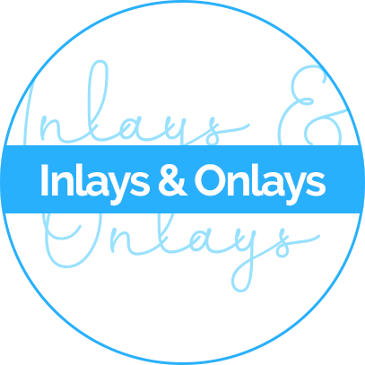 inlays and onlays